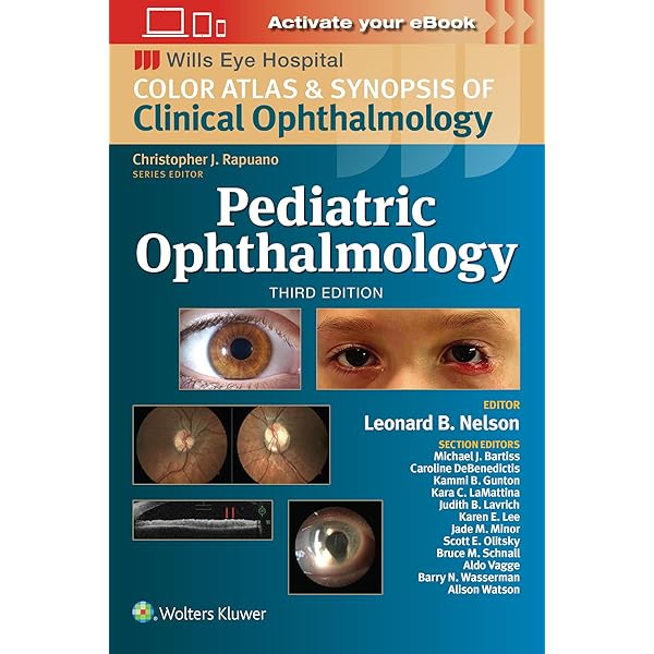 Clinical Atlas of Anterior Segment OCT: Optical Coherence