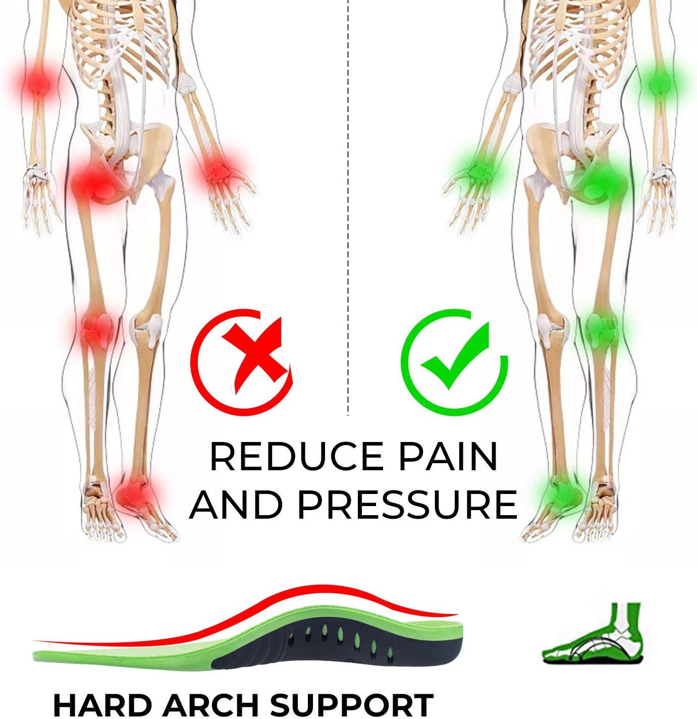 Shoe Insoles for Men Arch Supports Orthotics (2pair) Arch Pain Plantar Fasciitis Feet Insoles Inserts Relieve Flat Feet High Arch Foot Pain for Men Women (Green, (2pair) L: M10-12 / W 11-13 (11.81")): Health & Personal Care