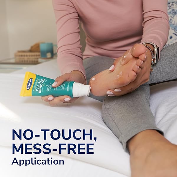 DR. SCHOLL’S FAST ACTING CALLUS REMOVER GEL KIT, HARD SKIN REMOVAL, SMOOTH SOFT FEET IN MINUTES, SALON PROFESSIONAL FORMULA, MESS FREE APPLICATION, EXFOLIATING FOOT FILE PEDICURE TOOL INCLUDED