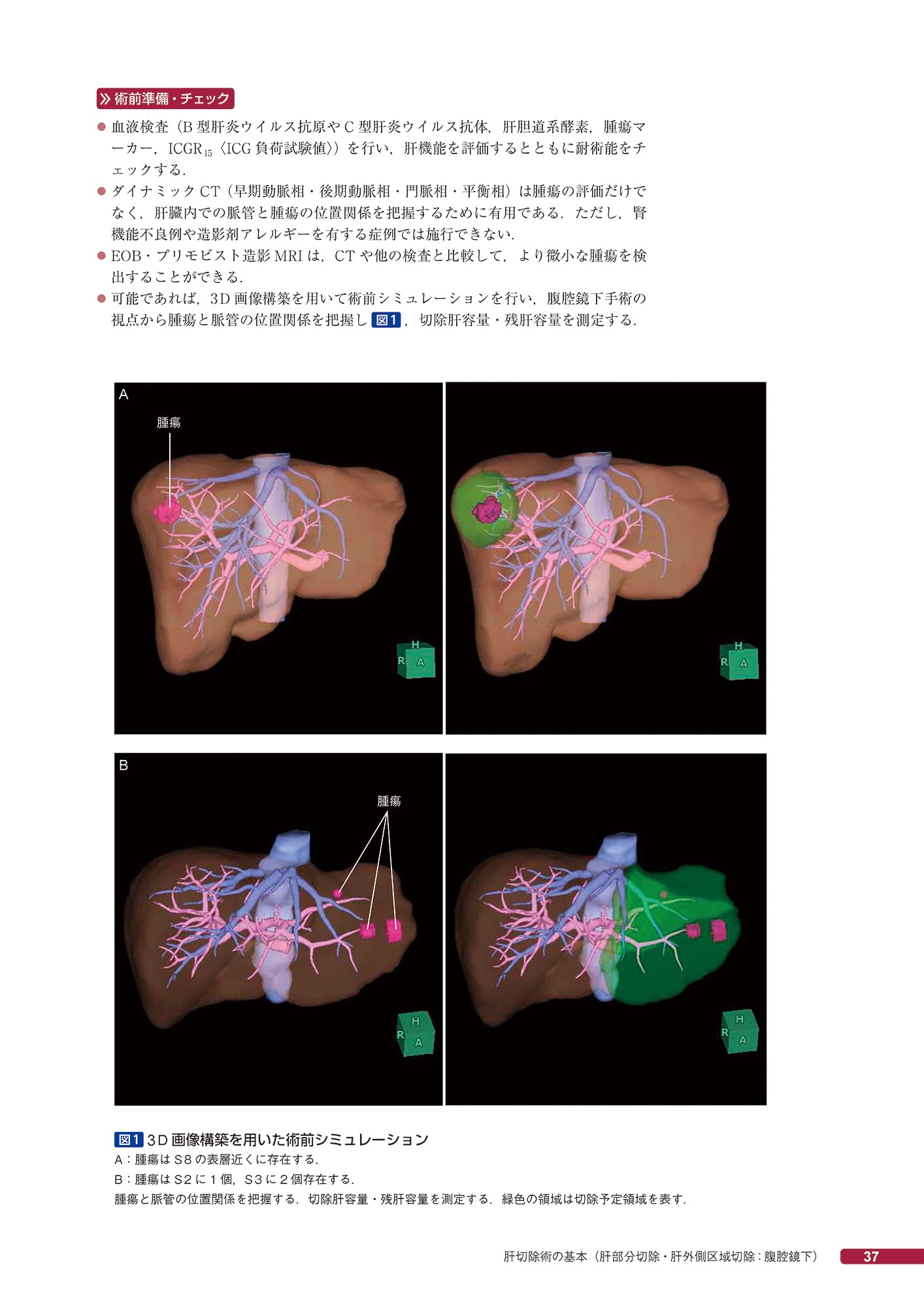 標準手技をイラストと動画で学ぶ 肝臓 脾臓 消化器外科手術 Tws Edu In 標準手技をイラストと動画で学ぶ 肝臓 脾臓 消化器外科手術 Tws Edu In