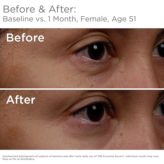 skinmedica tns essential serum costco