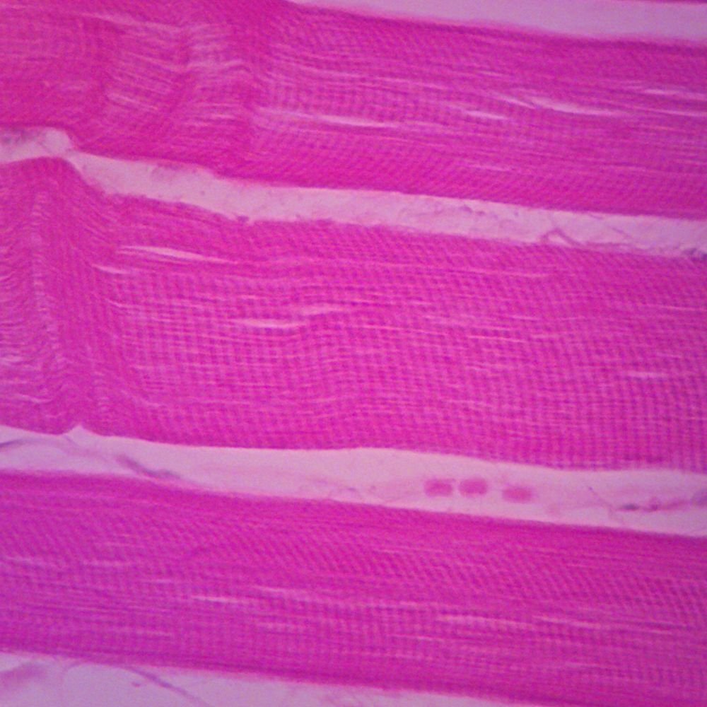 Adult Human Skeletal Muscle Slide, L.S., 7 M, H&E