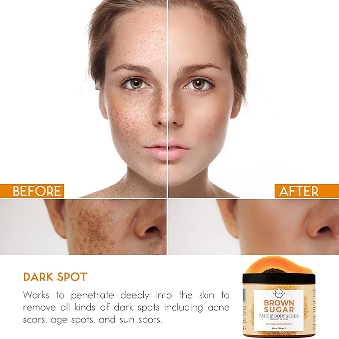 sugar scrub for face acne