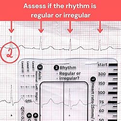 ECG 7 Step Ruler, ECG/EKG 7 Step Ruler Card for