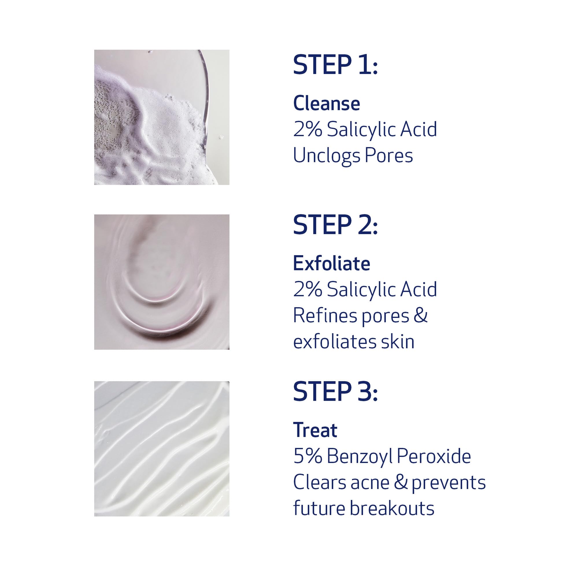 Obagi CLENZIderm M.D. Pore Therapy Exfoliating BHA Toner - Unclogs Pores with 2% Salicylic Acid Acne Treatment – 5 oz