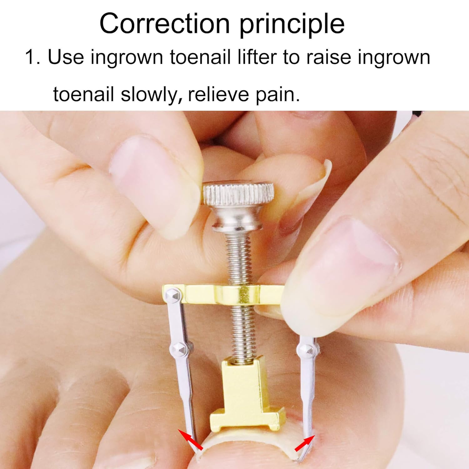 Ingrown Toenail Tools With Corrector Stickers, 30 Pcs Toe Nail Lifter Treatment Patch for Pedicure, Fix Curved Toenail Tape Recover Correction for Paronychia (Gold): Beauty