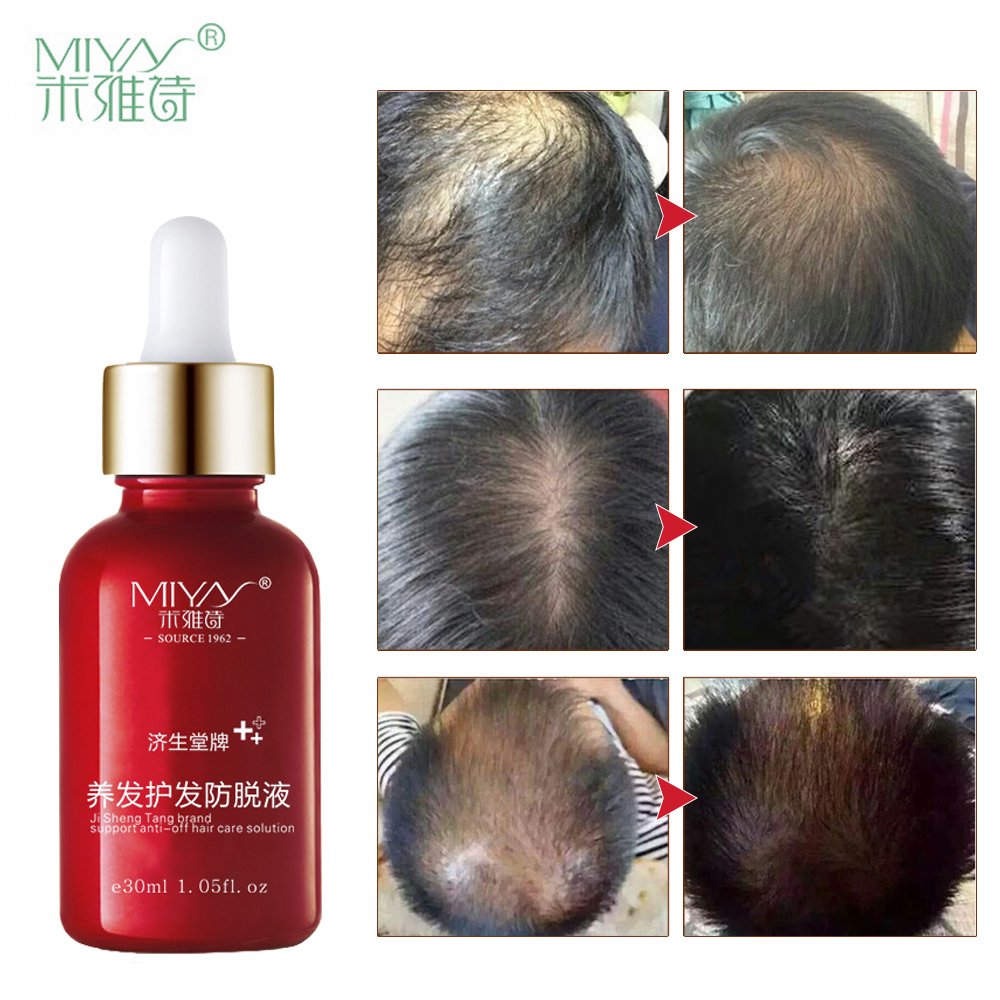 Buy Shreeyas Men S Hair Care Fast Powerful Hair Growth Products