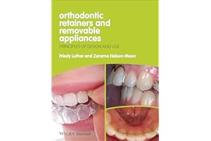 Orthodontic Retainers and Removable Appliances: Principles of Design and Use