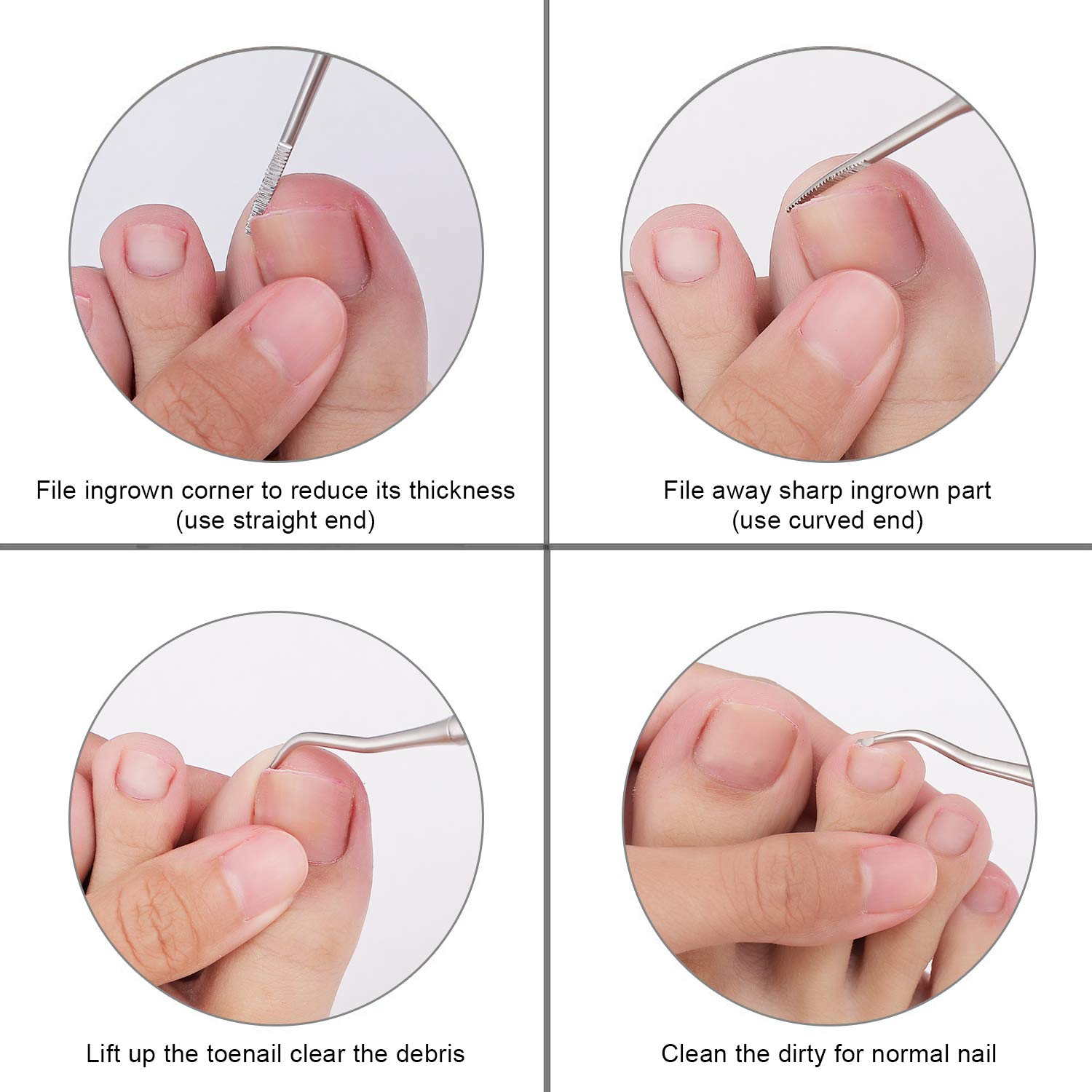 2PCS Ingrown Toenail File and Lifter with Storage Case,YINYIN100% Stainless Steel ingrown toenail tool,Double Sided Professional Grade Nail Cleaner Tool: Beauty