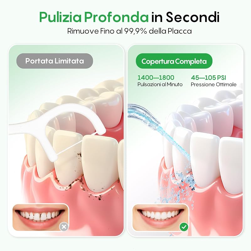 Idropulsore Dentale Portatile 300 ml Irrigatore Orale