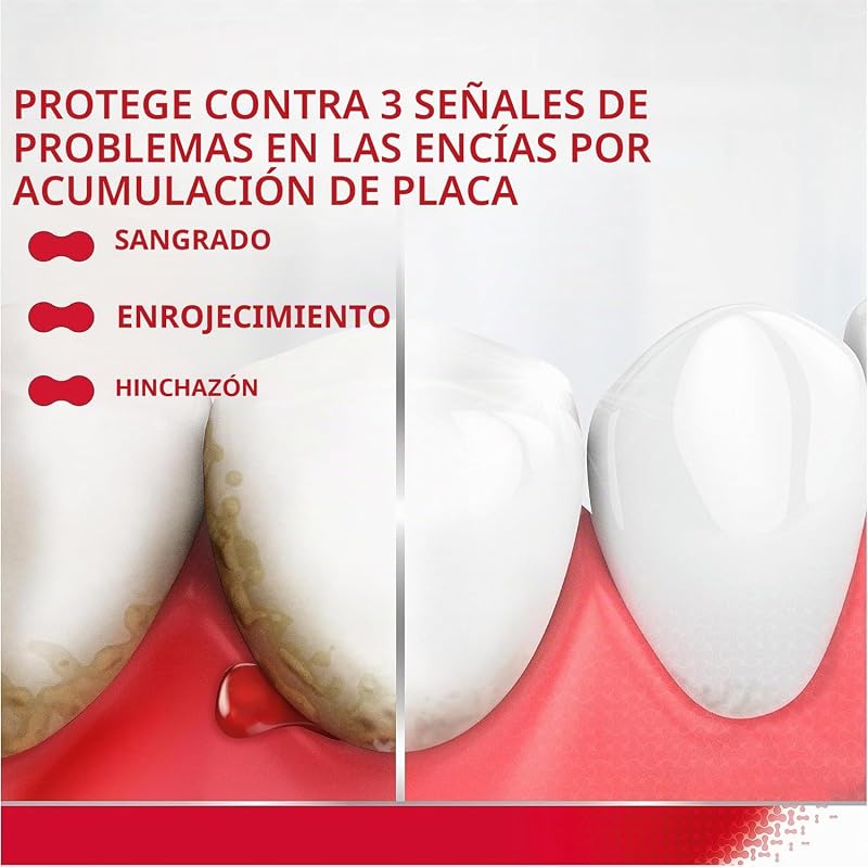 Ultra Clean, pasta de dientes que ayuda a reducir y prevenir el sangrado de las encías y mantener los dientes fuertes y el aliento fresco, 75 ml