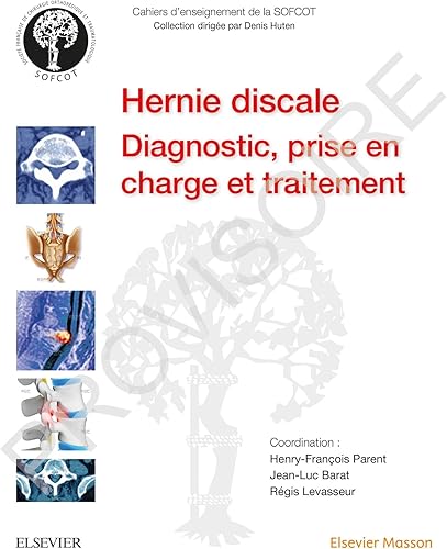 Download La hernie discale lombaire: Diagn,Prise En Ch Et Traitemt PDF