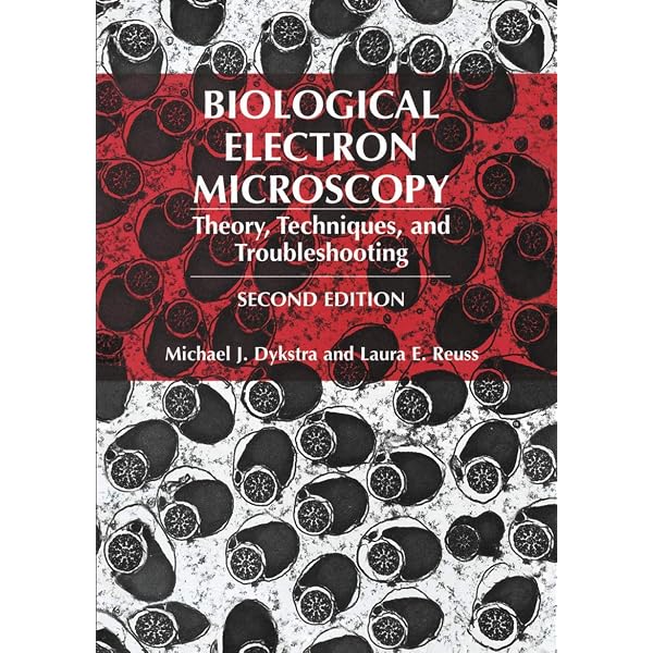 Amazon.com: Scanning Electron Microscopy and X-Ray Microanalysis