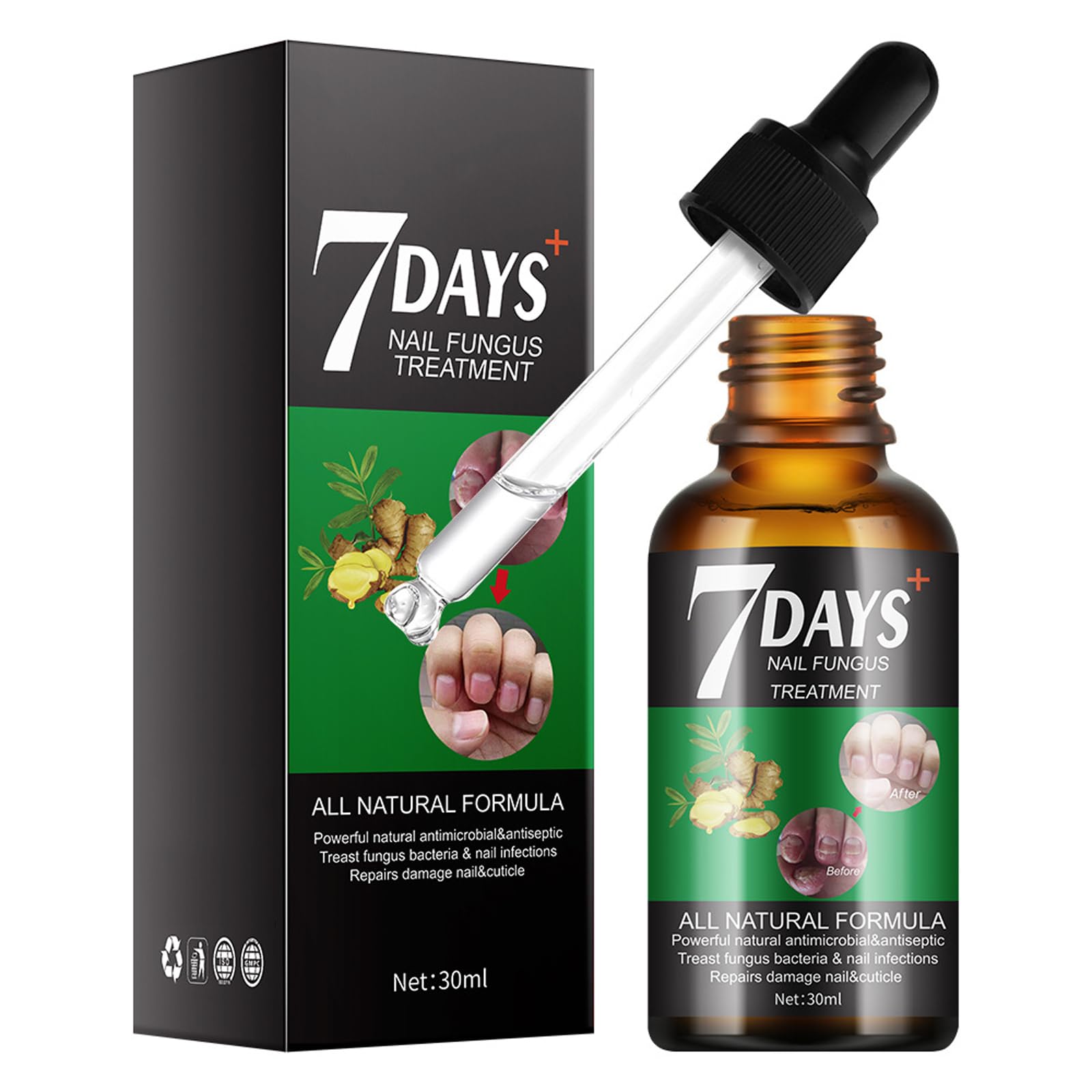 Nail Fungas Treatmant for Toenail - Toe Nail Fungas Treatmet - Toenail Fungul Treatmant Extra Strong - Anti Fungas Nail Repeir and Strengthen, Fix & Renew Damaged, Broken Nails