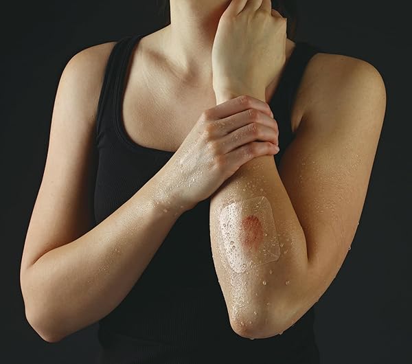 NEXCARE TEGADERM TRANSPARENT DRESSING, CLEAR FILM LETS YOU SEE WOUNDS HEAL, WATERPROOF DRESSING HOLDS FAST FOR 7 DAYS – 10 DRESSINGS