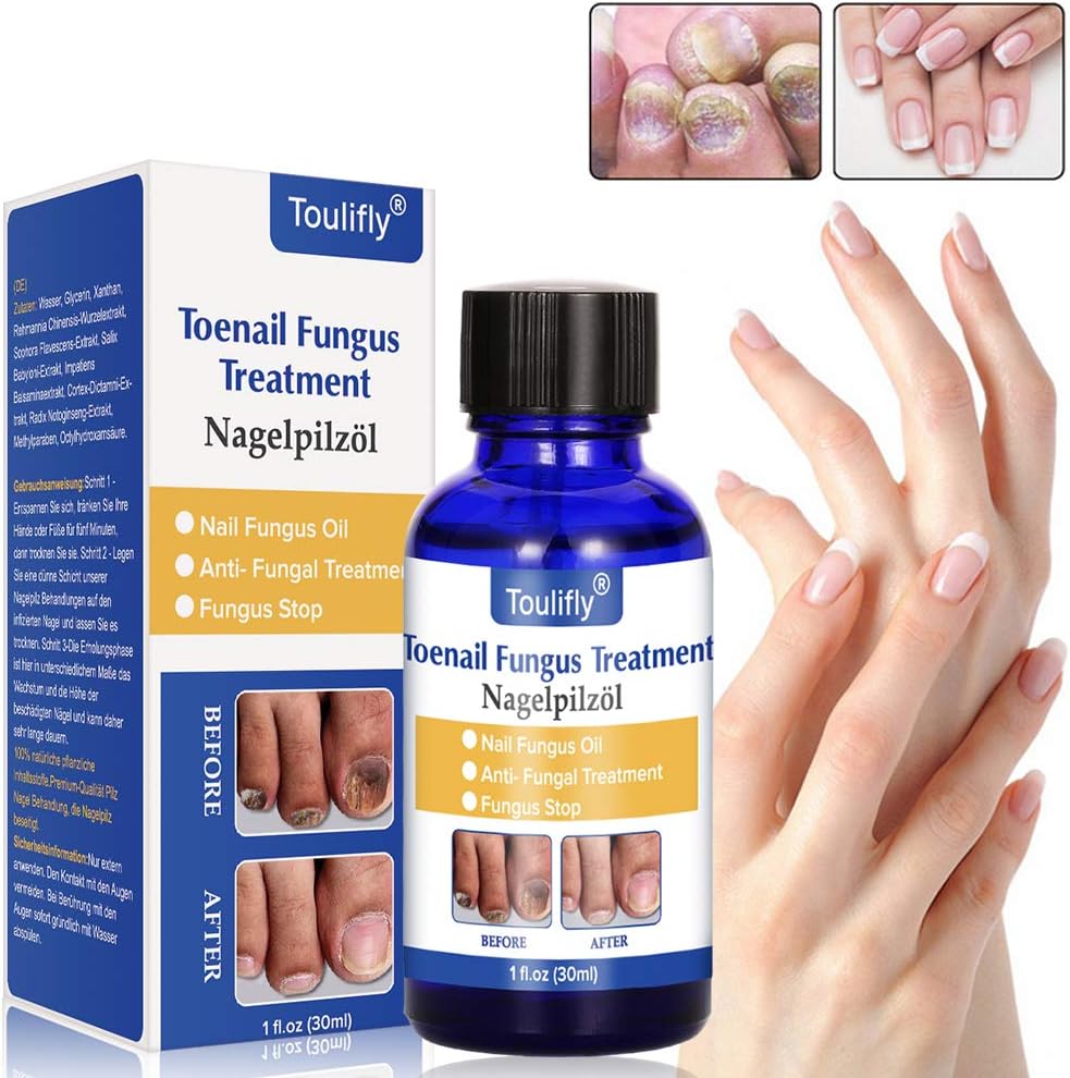 Fungus Stop, Nail Fungus Treatment, Anti Fungus Nail Treatment, Anti