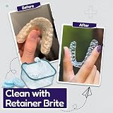 UK BEST BRANDS Retainer Brite Cleaning Kit 96 Tablets Case Blue view 2