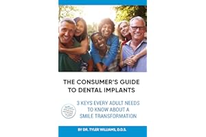 The Consumer's Guide to Dental Implants: 3 Keys Every Adult Needs to Know About A Smile Transformation