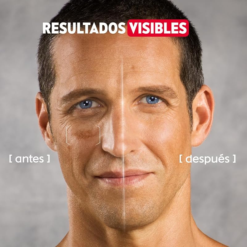 Nivea men power anti-aging serum 2 em 1 anti-manchas e antirrugas (1 x 30 ml), soro facial com luminous 630 para homens, soro anti-manchas com ácido hialurônico