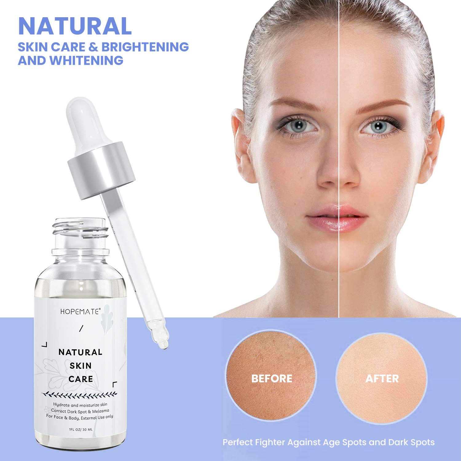 Skin Brightening Whitening Serum, HOPEMATE H Dark Spot Corrector