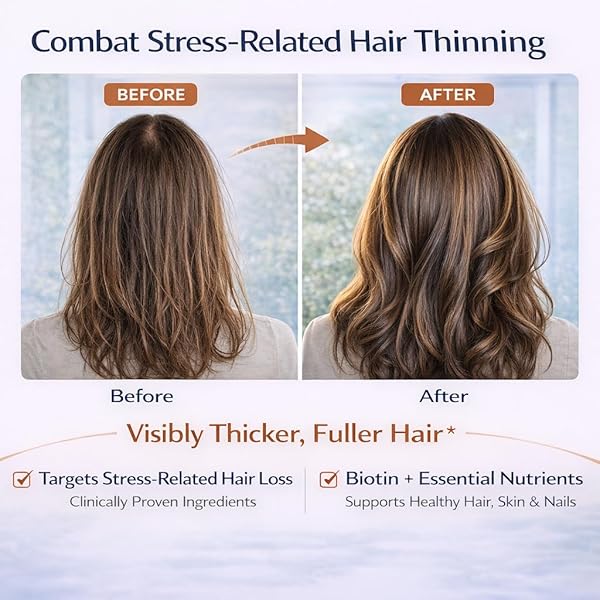 PUTRIZEN BIOTIN GUMMIES FOR STRESS HAIR THINNING – HELP RESTORE FULLER HAIR, STRONGER NAILS & GLOWING SKIN FOR BUSY WOMEN, EASY DAILY STRAWBERRY GUMMIES, 60 COUNT