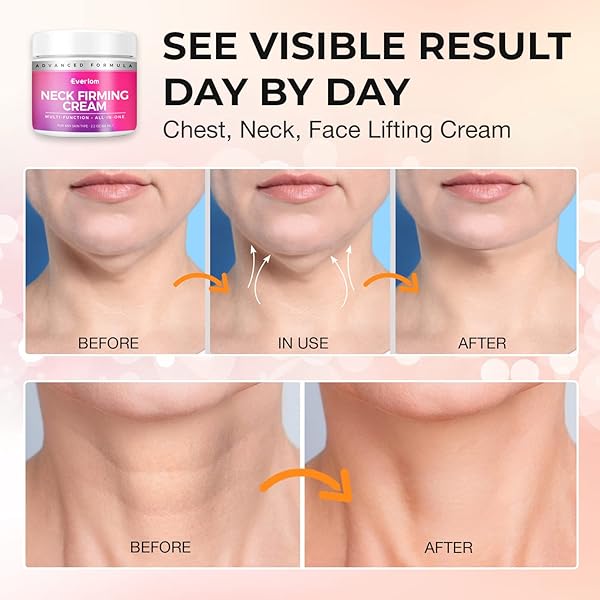 NECK CREAM FOR FIRMING TIGHTENING LIFTING: 65ML ANTI AGING TREATMENT FOR WRINKLES SAGGING SKIN – SUITABLE FOR NECK FACE JAW CHIN THROAT CHEST – FOR WOMEN MEN ADULTS SENIORS DAY NIGHT USE AT HOME WORK