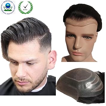 All You Need To Know About Mens Hair Replacement Systems Mens Hair