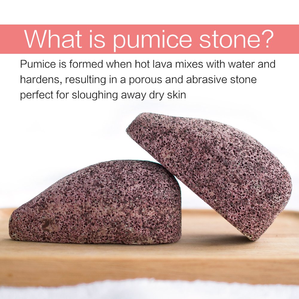 2 Pack Drops Shape Pumice Stone, Horsky Earth Lava SPA Soft Healthy Foot Callus Remover for Dry Hard Dead Skin Cracked Heel in Feet and Hands Skin Exfoliator Scrubber