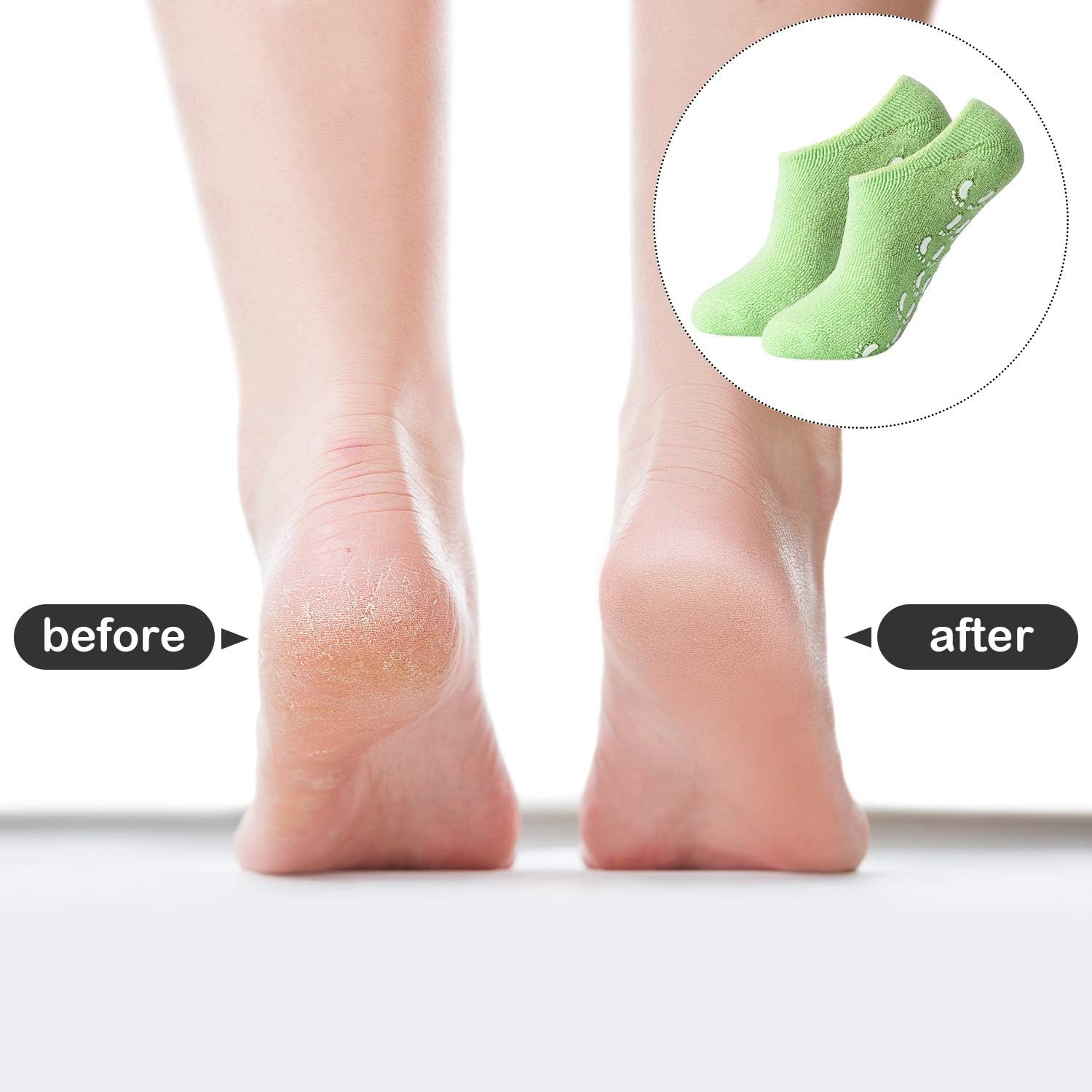 3 Pairs Moisturising Socks Cotton Moisture Improve Socks Foot Spa Socks