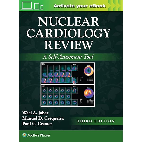 洋書 Atlas of Nuclear Cardiology 2nd edition Pocket Radiation Oncology: 9781975218942: Medicine & Health