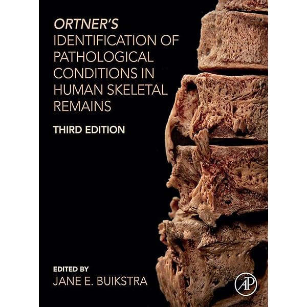 Amazon.com: Human Osteology eBook : White, Tim D., Black, Michael