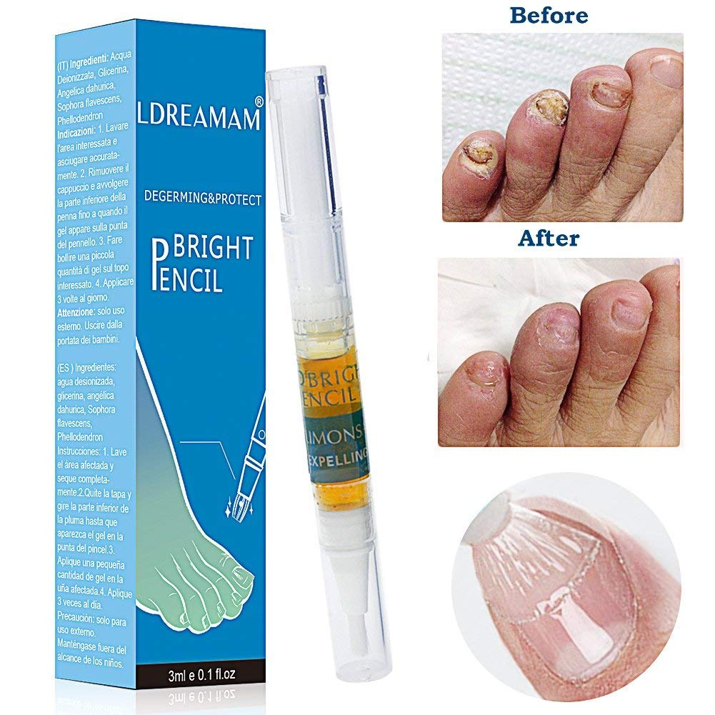 Nail Fungus Treatment,Fungus Stop,Nail Antifungal Treatment,Nail Fungus