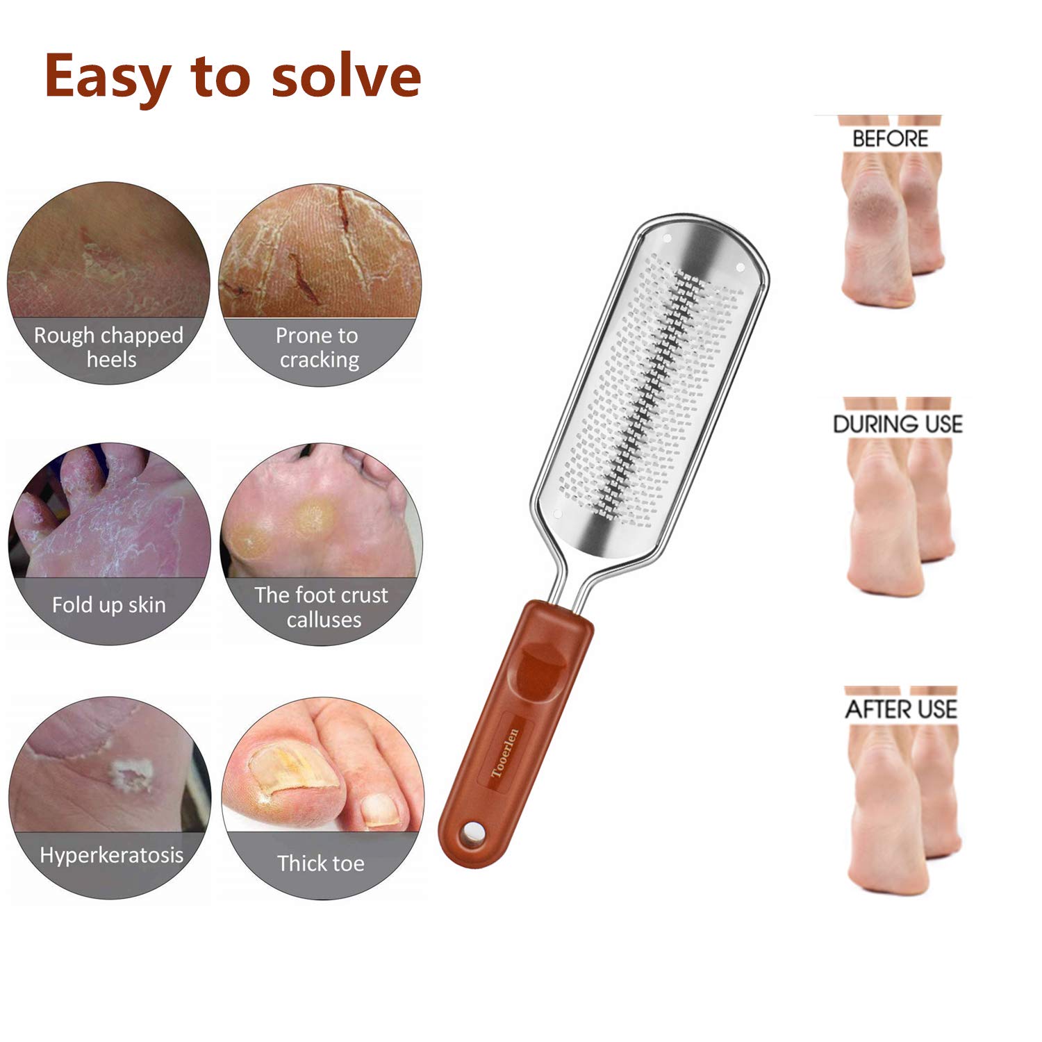 Tooerlen Foot Rasp Foot File Foot Grater, Can be Used on Both Wet and Dry Feet, Best Foot Care Pedicure Metal Surface Tool to Remove Hard Skin, for Extra Smooth and Beauty Foot- (Colossal) : Beauty