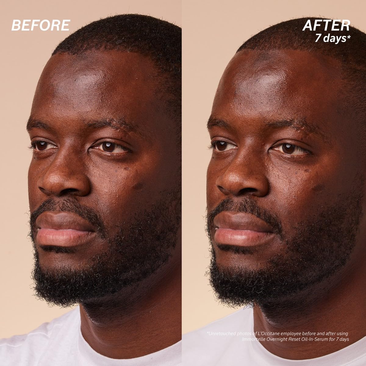 L'Occitane Immortelle Overnight Reset Oil-In-Serum: More Radiant Skin In 1 Night, Smooth Fine Lines, Revitalize Dull Skin, Award-Winner