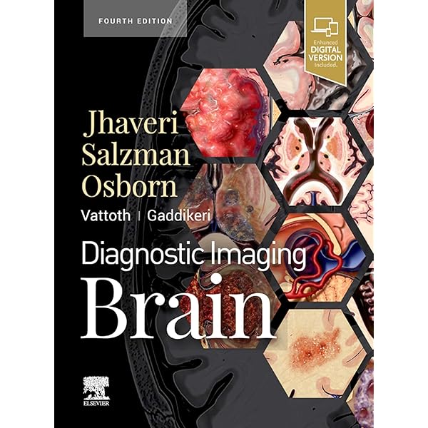 Osborn&#39;s Brain:他合わせて5冊 Osborn's Brain:他合わせて5冊 71UrI5Q--aL._UF894,1000_QL80_.jpg