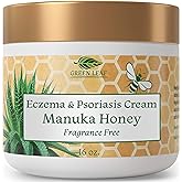 Manuka Honey Eczema Cream Moisturizing Lotion Fragrance Free For Psoriasis Relief - Itchy, Dry Skin Rash Ointment - Skin Soothing Moisturizer - Body & Face Cream - Kids & Adults 16oz