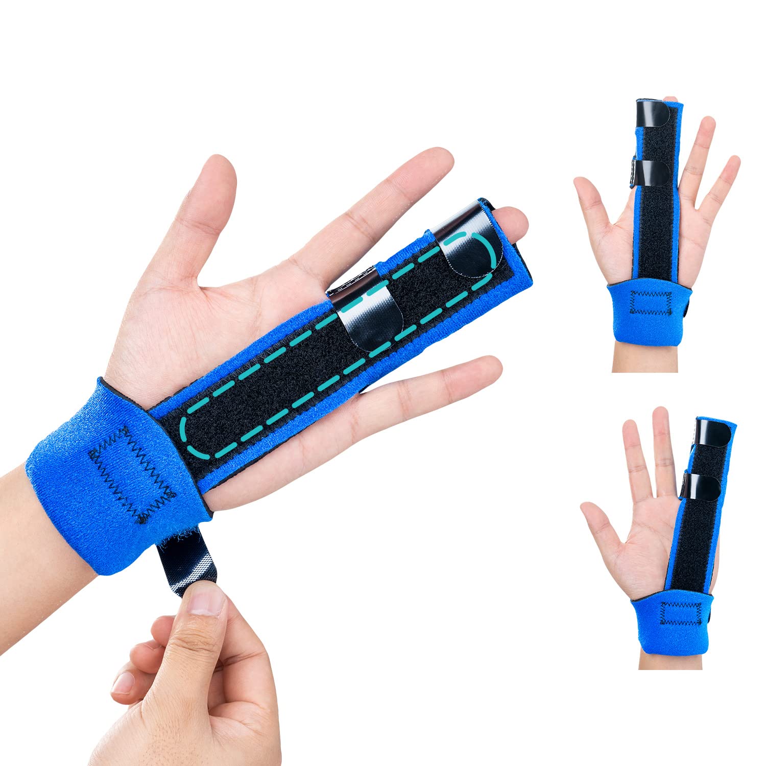 DrFinger Broken Finger Splint for Trigger Finger,Injured, Arthritis Pain, Adjustable Brace with 2 Aluminum Plate, Keep Fingers Straight (2-Fingers)