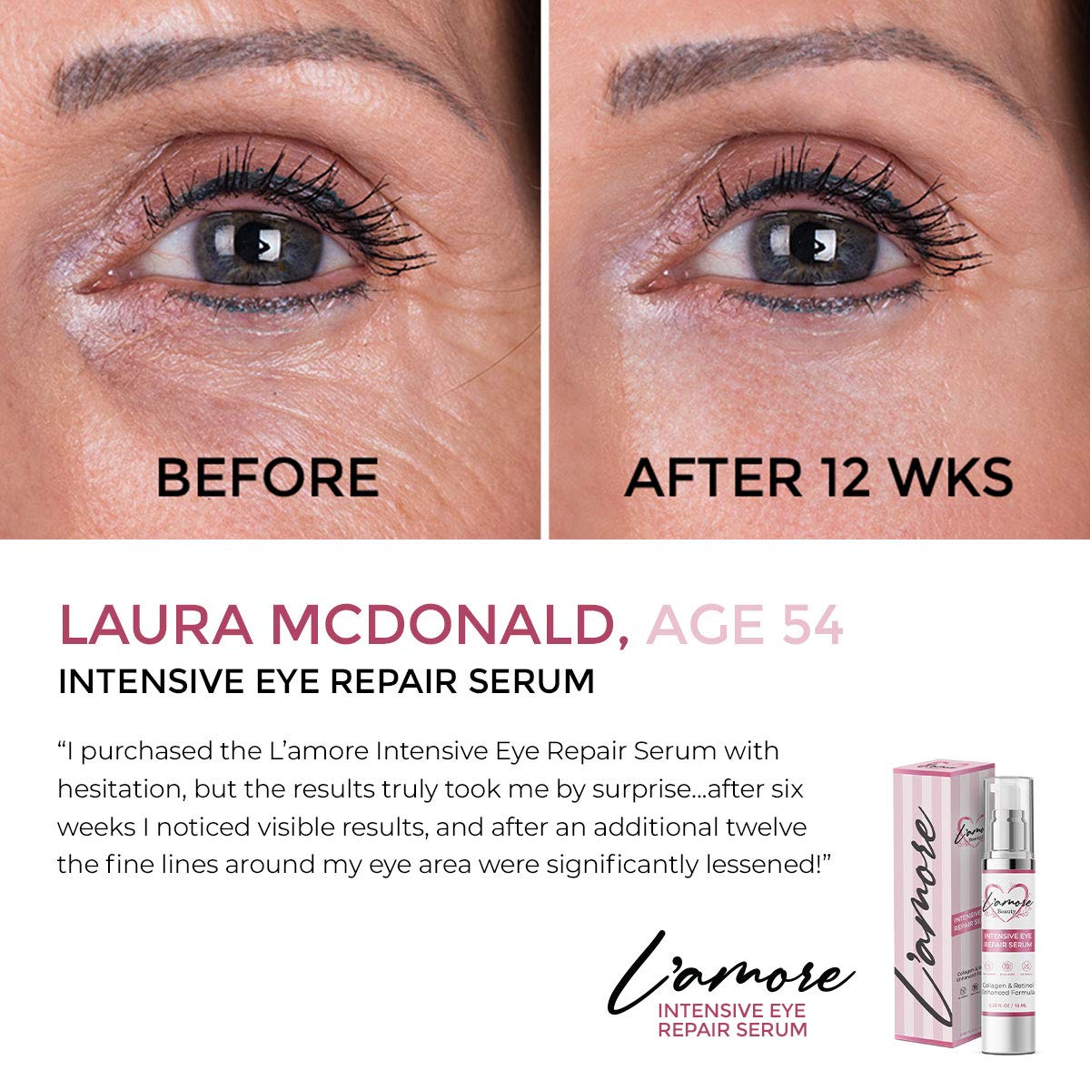 intensive eye repair