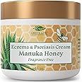 Manuka Honey Eczema Cream Moisturizing Lotion Fragrance Free For Psoriasis Relief - Itchy, Dry Skin Rash Ointment - Skin Soothing Moisturizer - Body & Face Cream - Kids & Adults 16oz