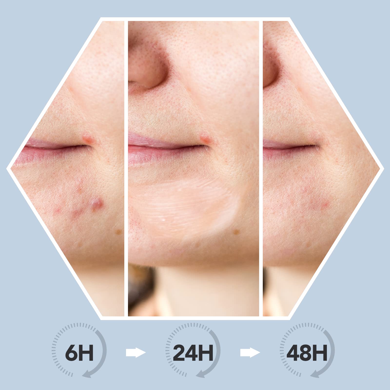 AUSLKA Balm