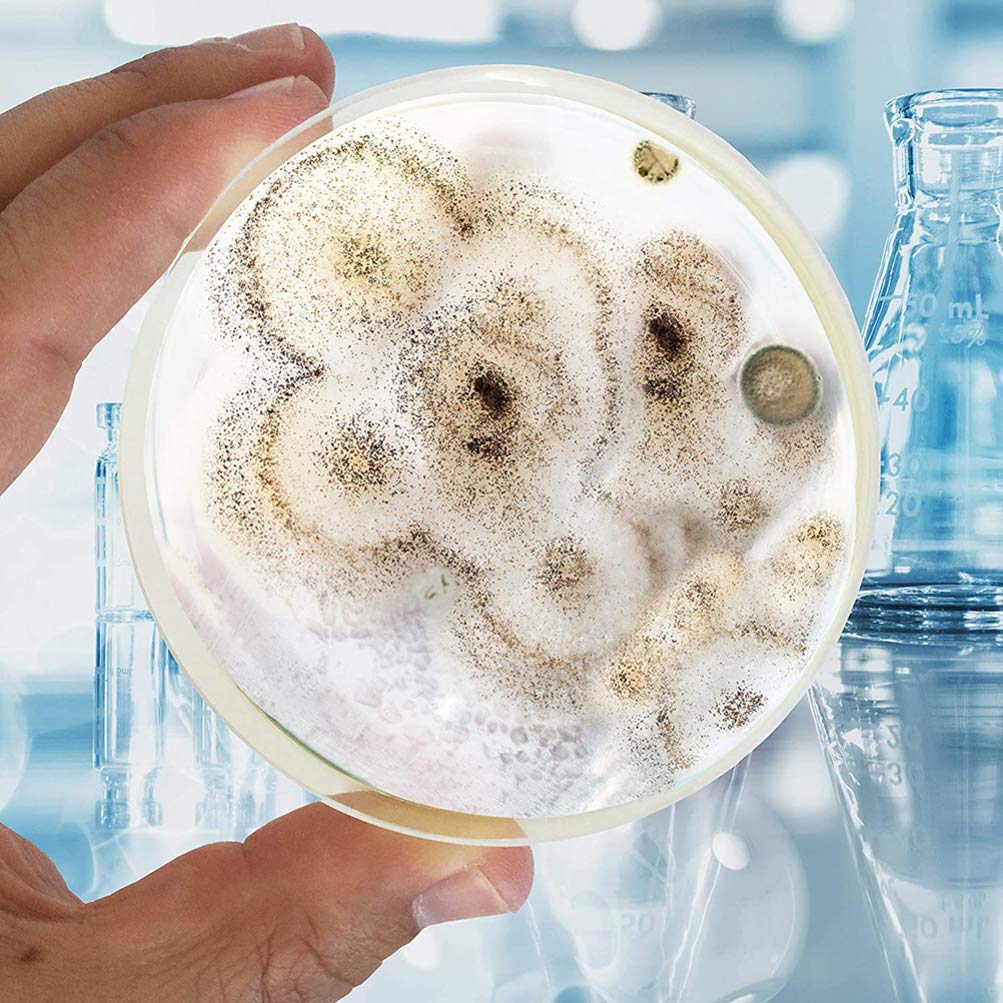 Vacuum Packaging ULTECHNOVO 10pcs Disposable Agar Plates Prepoured