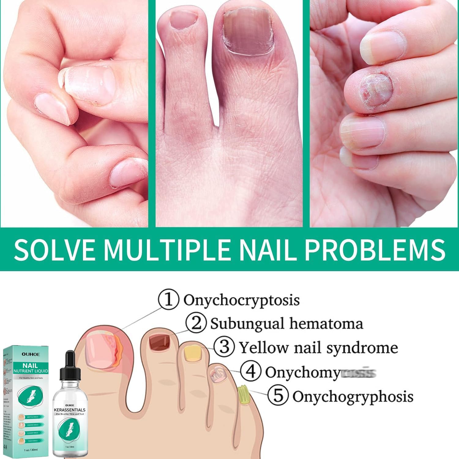 Kerassentials Toenail Oil, Kerassentials Nails colourless (3PCS) - Image 4