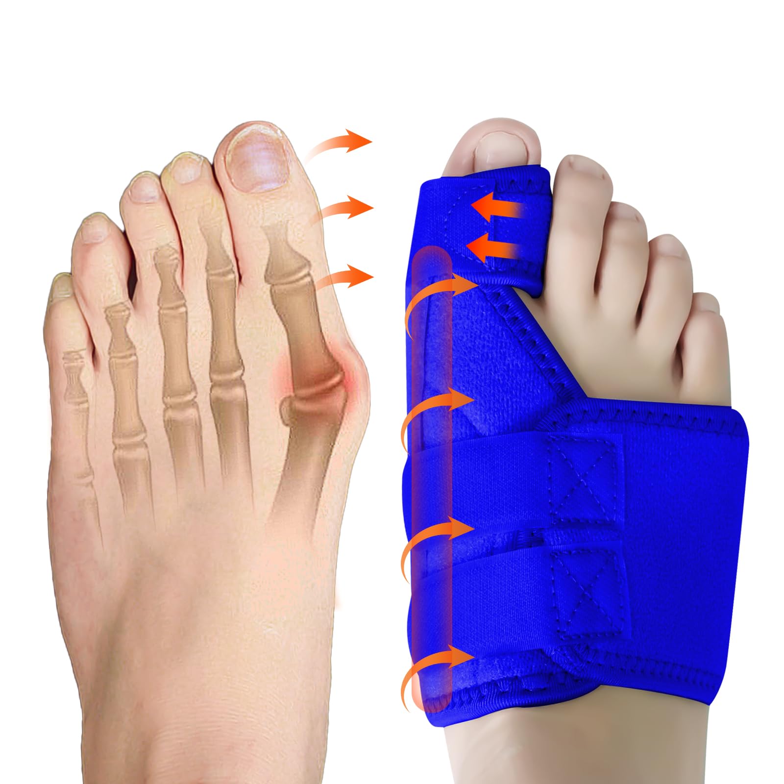 Ruilaibao Bunion Corrector Big Toe Straightener for Women and Men Bunion Splint for Big Toe Pain Relief Bunion Support for Day Night Foot Pain Relief (Royal blue, right)