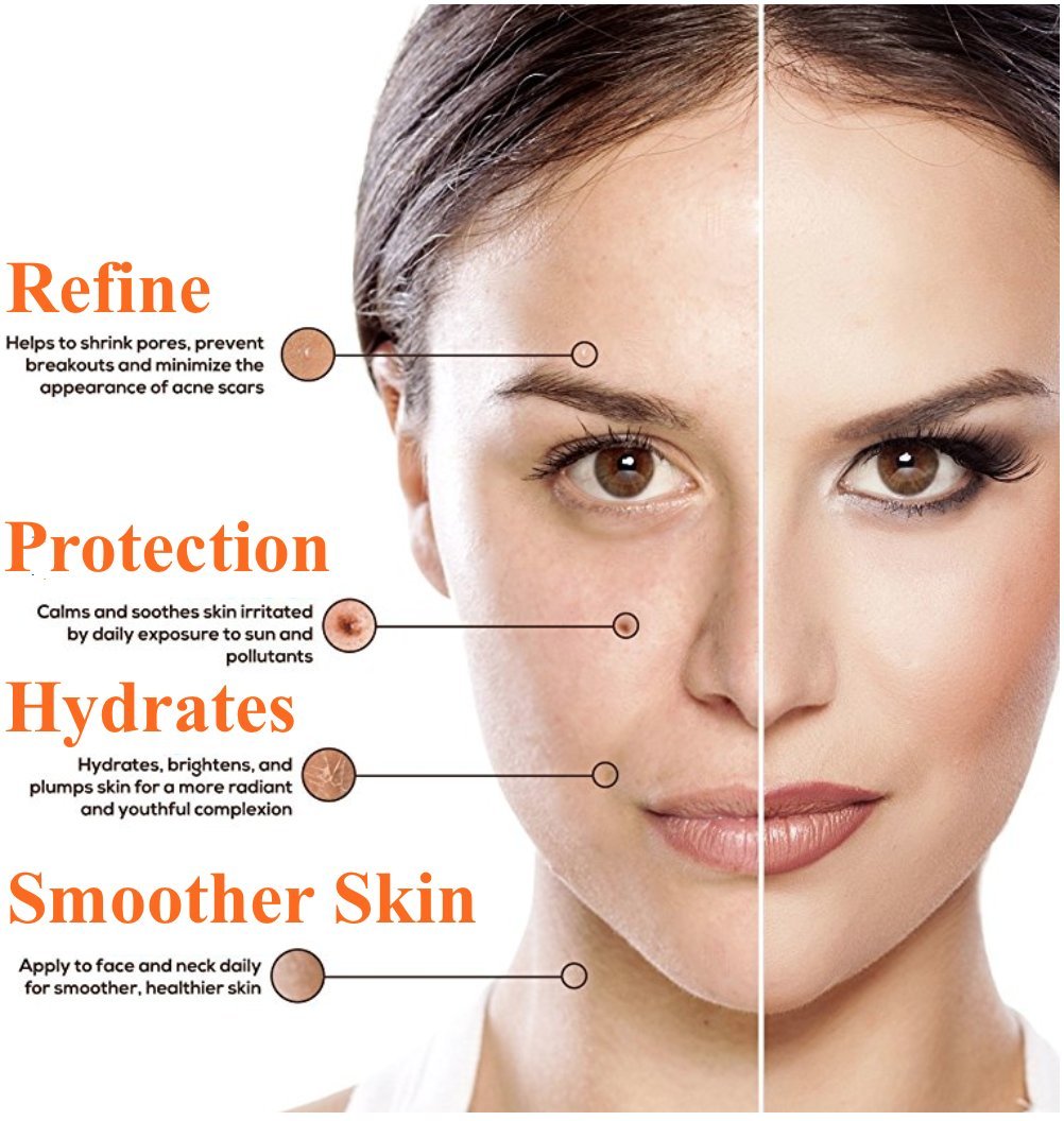 Vitamin C Serum für das Gesicht - Riesig 60ml Flasche - Beste Natürliche Formel mit Klinische Stärke von reines Vitamin C, Hyaluronsäure, Vitamin E & Bio-Jojobaöl - Für Alle Hauttypen