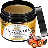 TKTALKER Raw Batana Oil for Hair Growth, 100% Pure, Dr. Sebi Batana Oil from Honduras, Organic, Unrefined, Prevents Hair Loss, Hair Care, Enhances Hair Thickness in Men & Women 4.2 oz