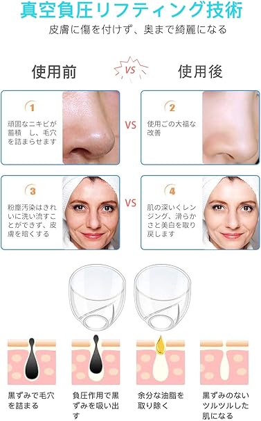Amazon 毛穴を小さくするために 令和最新発売 毛穴クリーン 毛穴吸引器 6階段吸引力調整可能 黒ずみ吸出 ニキビ吸引 毛穴ケア美顔器 角質ケア たるみ改善 美肌 エステ シワ減少 毛穴汚れ 毛穴角栓除去 鼻黒ずみ吸引 スポットクリア 日本語取扱説明書付き 男女兼用