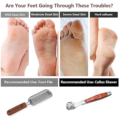 Buy Colossal Foot Rasp Wood Handle Callus Shaver 10 Replacement 1 Foot File Heads Pedicure Foot File Kit Heel Scraper For Feet Foot File Callus Remover Online In Kazakhstan B08crlbny4