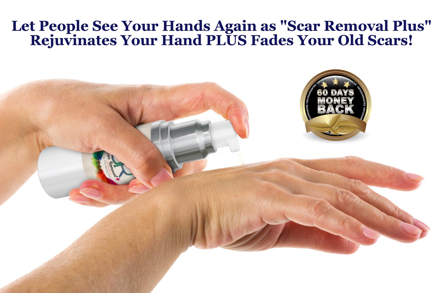 Scar Removal Plus Vitamin C. Scar Therapy Cream For Keloids, Acne