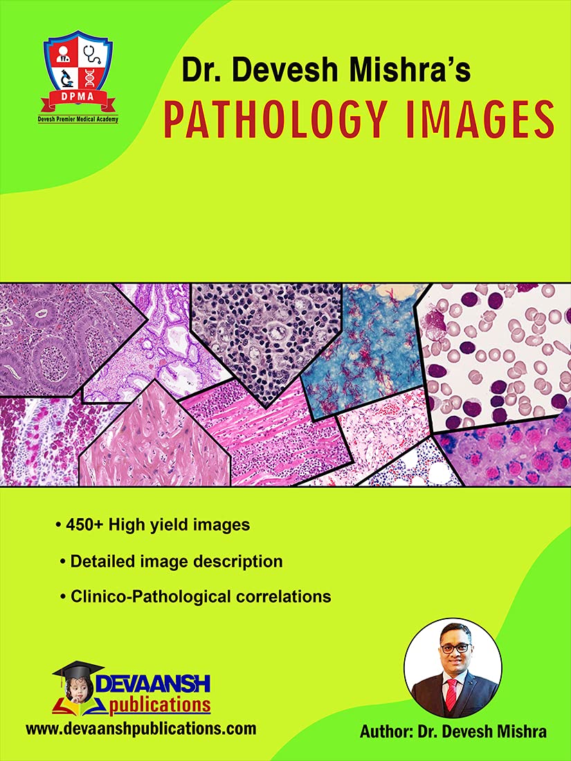 DR DEVESH MIHSHRA’S PATHOLOGY IMAGES DR DEVESH MIHSHRA’S PATHOLOGY IMAGES