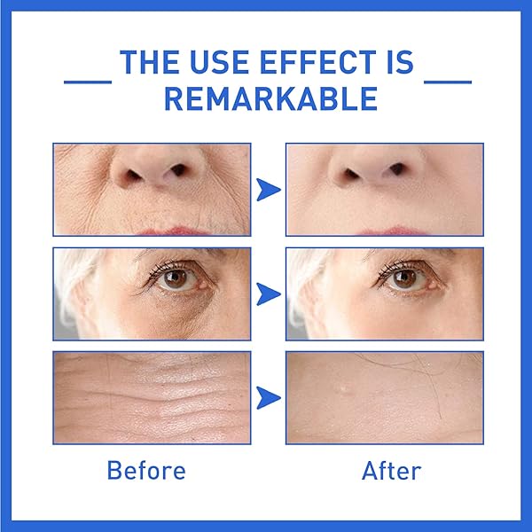 2PCS FACE SERUM ANTI-AGING COLLAGEN SERUM FOR FACE REDUCE FINE LINES WRINKLES BOOST SKIN COLLAGEN HYDRATE & PLUMP SKIN(2 X 30ML)